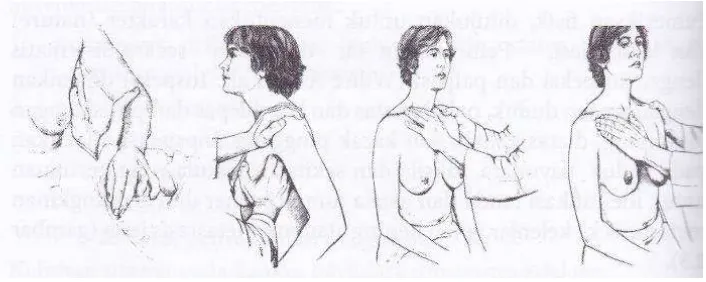 Gambar 2.4  Teknik melakukan inspeksi saat lengan disamping, diatas kepala dan kacak pinggang dan palpasi parenkim payudara untuk identifikasi kelainan primer