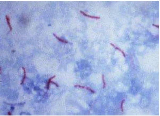 Gambar 2.1. Gambaran Mikroskopis M. tuberculosis 
