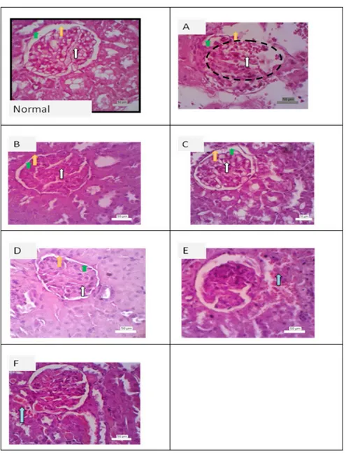 Gambar 8.   Perbedaan Histotologi Lesi Glomerulus dan Ekstraglomerulus Ginjal
