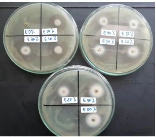 Gambar 1. Hasil Uji aktivitas antibakteri pada MHA (Mueller Hinton Agar) 