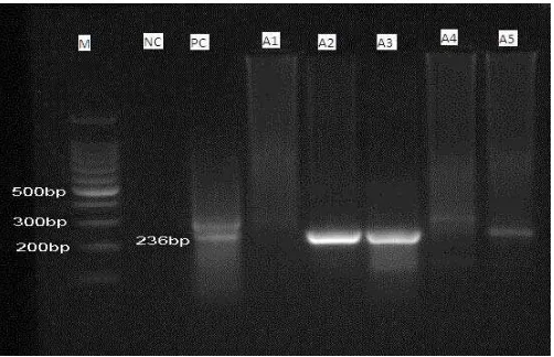 Gambar 4.1 Analisis DNA produk PCR Aspergillus fumigatuselektroforesis gel agarosa. menggunakan  Lajur 1: Marker, Lajur 2: Kontrol negatif, Lajur 3: Kontrol Positif, Lajur 4-8: sampel A1 – A5