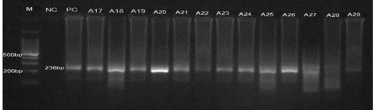 Gambar 4.2 Analisis DNA produk PCR Aspergillus fumigatuselektroforesis gel agarosa. menggunakan  Lajur 1: Marker, Lajur 2: Kontrol negatif, Lajur 3: Kontrol Positif, Lajur 4-15: sampel A5 – A16