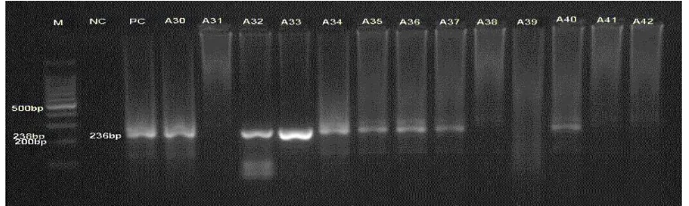 Gambar 4.5 Analisis DNA produk PCR Aspergillus fumigatus menggunakan elektroforesis gel agarosa