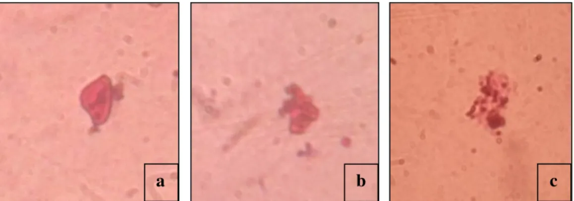 Gambar 1. Proses Fagositosis Bakteri S. iniae. a. Pelekatan; b. Penghancuran; c.  Pelepasan hasil fagositosis 