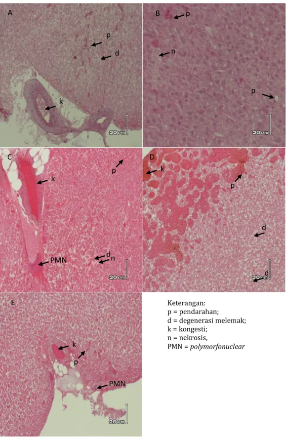 Gambar 3. Histopatologi Hati Ikan Nila pada Berbagai Perlakuan (A :  Suplementasi Ulva sp