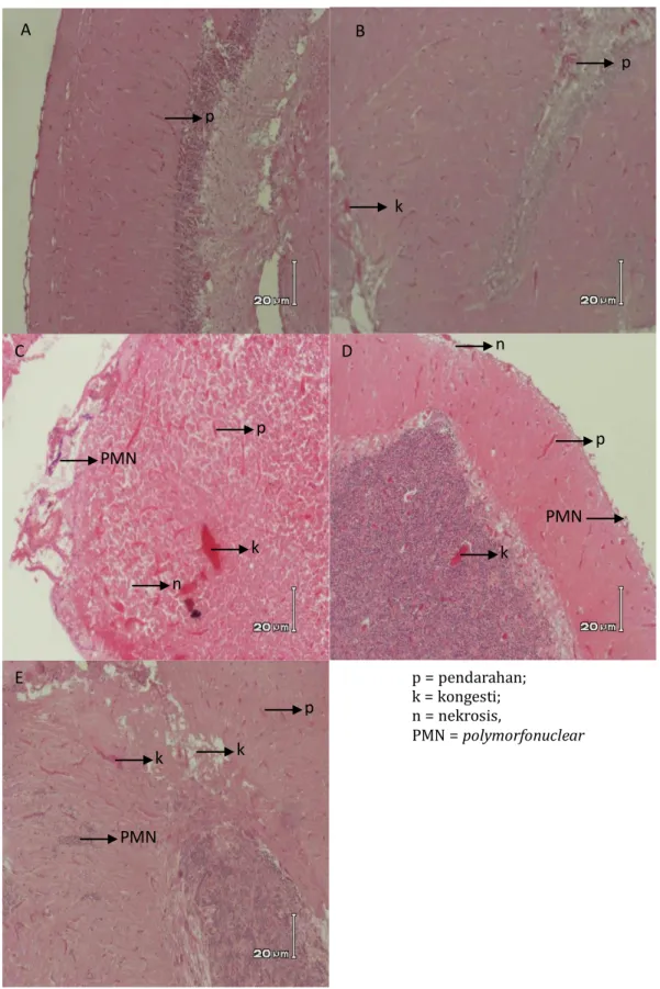 Gambar 5. Histopatologi Otak Ikan Nila pada Berbagai Perlakuan (A : Suplementasi  Ulva sp