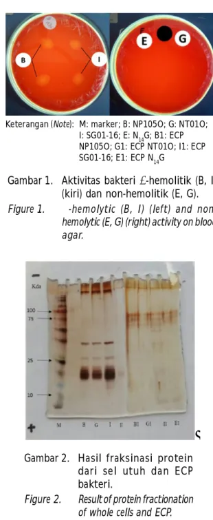 Gambar 1. Aktivitas  bakteri  -hemolitik  (B,  I) (kiri) dan non-hemolitik (E, G). Figure 1