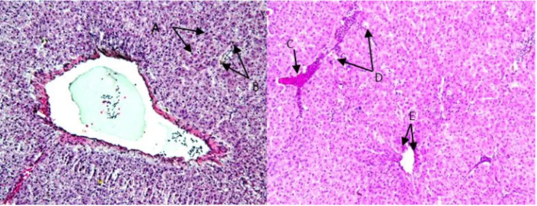 Gambar 4. Hati:  peradangan  sel  (A),  nekrosis  (B),  pendarahan  (C),  vakuola  pada sitoplasma (D), kongesti di sinusoid dan hilangnya hepatosit (E).