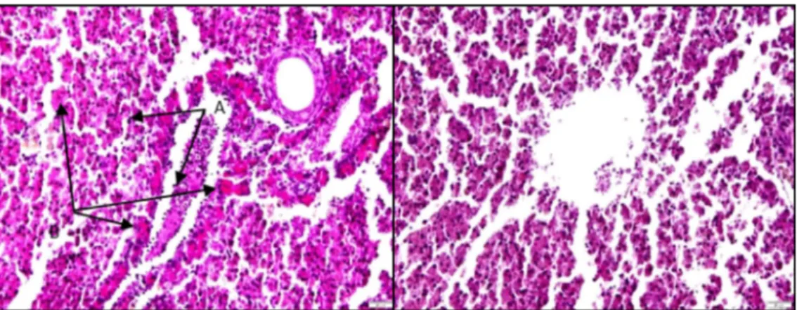 Gambar 5. Limpa: nekrosis (A), infiltrasi sel radang (B). Figure 5. Spleen: necrocis (A), infiltration of inflammatory cell (B).