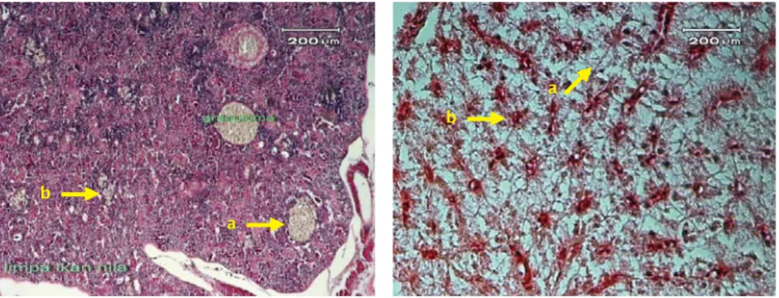 Figure 1. Necrosis of liver and spleen cells