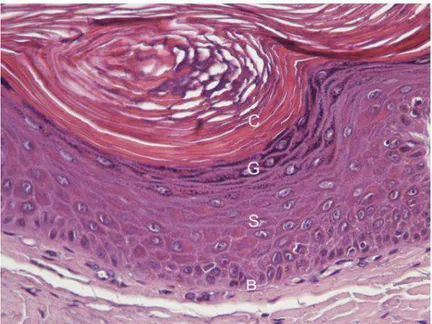 Gambar 3. Histologi epidermis: epidermis hiperplastik, di mana lapisan epidermis  yang  berbeda  didefinisikan  dengan  baik:  (b)  stratum  basale,  (s)  stratum  spinosum,  (g)  stratum  granulosum  dan  (c)  stratum  corneum  (Albanese 2017)