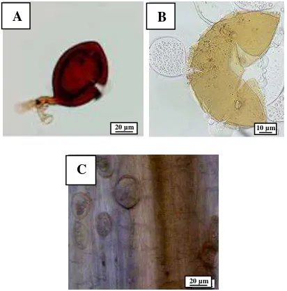 Figure 3. Mycorrhizal. (A) Spore; (B) Broken spore; (C) Infection of plant root 