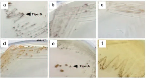 Gambar 3. Isolat Burkholderia glumae yang diisolasi dari sampel biji padi: (1) IRP.3, (2) IRP.6b, (3) InSB.3a, dan (4) InSB.6a, serta isolat B