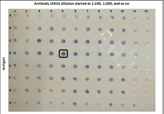 Figure 4. Checkerboard test results of DNA derived from leukocytes of a healthy individual and antibodies obtained from the serum of a SLE patient with high anti-dsDNA levels