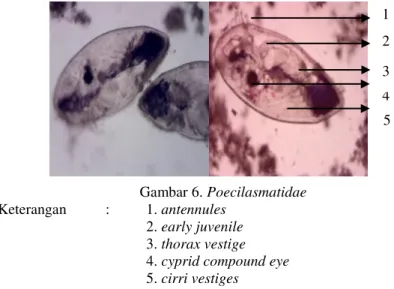 Gambar  5 memperlihatkan  bahwa  Vorticella  sp.  yang  ditemukan  berbentuk  seperti  lonceng,  berwarna  kekuning-kuningan,  memiliki  contracted  cell,  macronucleus,  adoral  membrane  dan  tangkai  yang  panjang