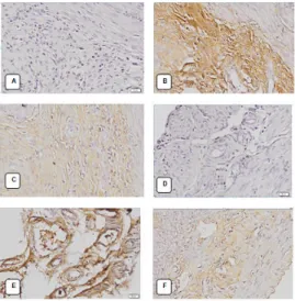 Gambar  4.  Gambaran  ekspresi  PGF2α  Uterus tikus betina galur wistar  dengan  pembesaran 200x :  