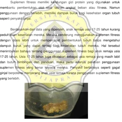 Gambar 1.5.2.1 Contoh Batu Ginjal 