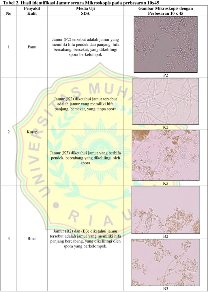 Tabel 2. Hasil identifikasi Jamur secara Mikroskopis pada perbesaran 10x45  No  Penyakit Kulit  Media Uji SDA 