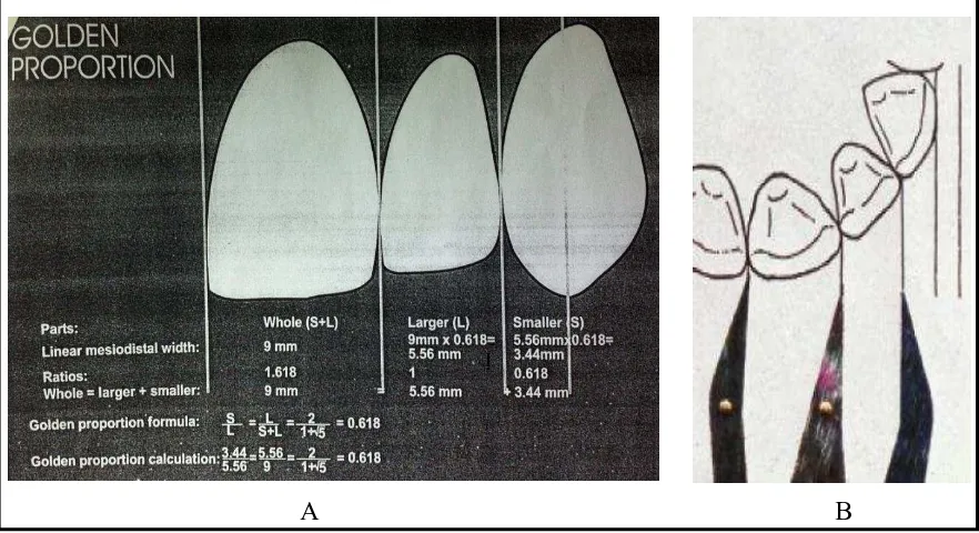 Gambar 7. Konsep golden proportion pada gigi insisivus sentralis, insisivus lateralis    dan kaninus rahang atas.7,27 A