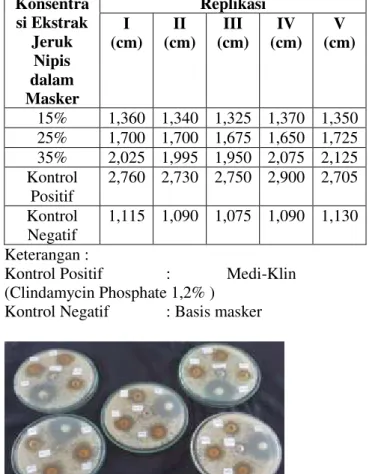 Tabel  V.  Diameter  zona  hambat  masker  gel  peel-off  ekstrak  etanol  kulit  jeruk  manis   Konsentra si Ekstrak  Jeruk  Nipis  dalam   Masker  Replikasi I (cm) II (cm) III  (cm)  IV  (cm)  V  (cm)  15%  1,360  1,340  1,325  1,370  1,350  25%  1,700  