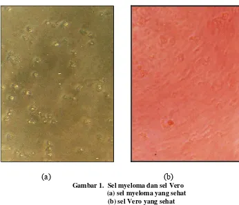 Gambar 1.  Sel myeloma dan sel Vero 