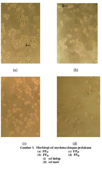 Gambar 3.  Morfologi sel myeloma dengan perlakuan 