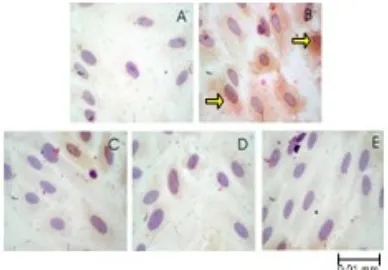 Gambar 6. Kultur HUVECs hasil imunohistokimia untuk melihat ekspresi TNF-α.  