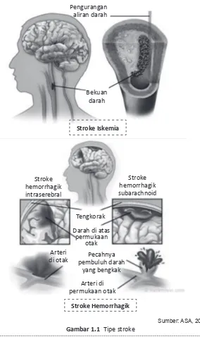 Gambar 1.1 Tipe stroke