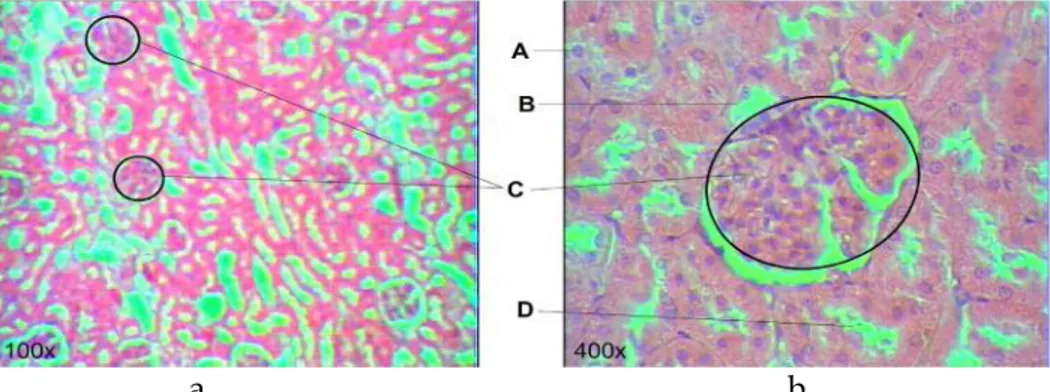 Tabel 1. Hasil pemeriksaan mikroskopis sel ginjal tikus 5 hari setelah pemberian nefrotoksin uranium