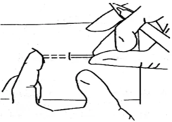 Gambar 6. Menempatkan posisi ujung bawah kapsul berada di bawah insisi 