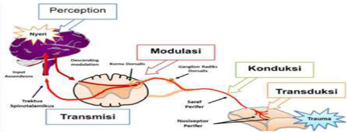 Gambar  2.  Lintasan nyeri  dan intervensi  yang  dapat  memodulasi  aktivitas nyeri  pada tiap  poin