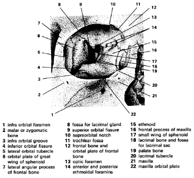 Gambar 1. Tulang orbita dari orbit kanan bagian depan. 