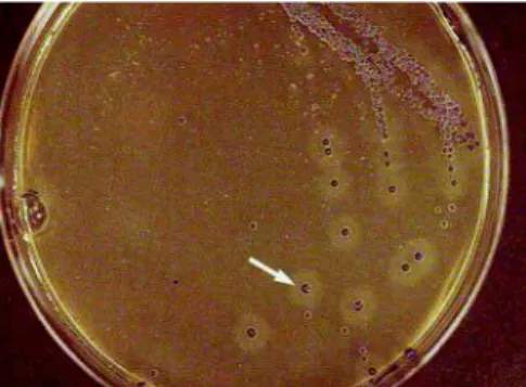 Gambar 2. Koloni S. aureus pada media BPA  umur  24  jam  (David 1999).