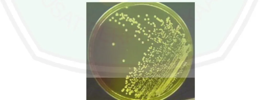 Gambar 2.3. Koloni Staphylococcus aureus pada media MSA  (Pillai, 2012) 