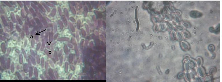 Gambar 2. Identifikasi pewarnaan tak langsung dan gram secara Mikroskopik dengan perbesaran 100x 