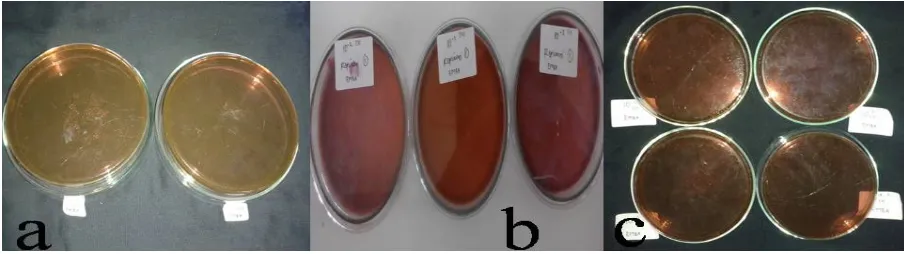Gambar 1. Hasil identifikasi bakteri Escherichia coli pada medium EMBA (a) sampel 1, (b) sampel 2, dan (c) sampel 3