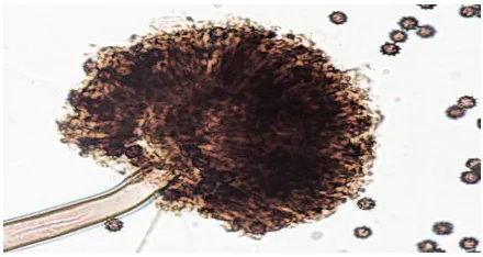 Gambar 5. Aspergillus nigerperbesaran 100 x 4 (Fivien, 2017) 