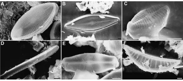Gambar  Diatom. Jenis  diatom  oleh  Pedora  Thomas dkk  (2006-2009) di Spanyol. Didymosphenia