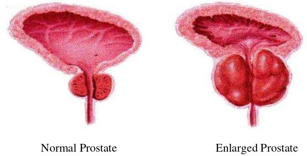 Gambar 2.3. Kelenjar prostat 