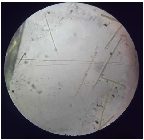 Gambar 8. Hasil Uji Kualitatif Kalsium dengan Asam Sulfat 1 N 