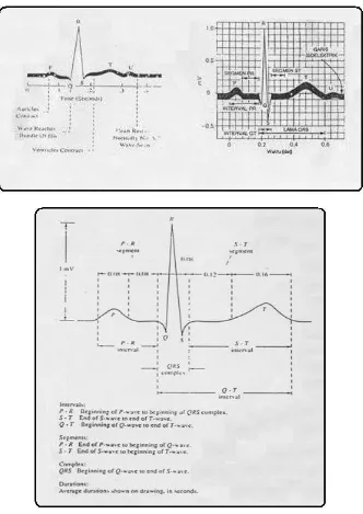 Gambar 2-2. Sinyal EKG standar 