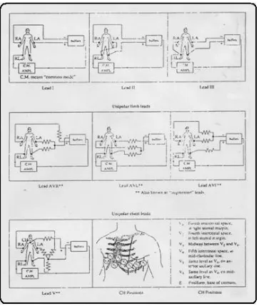 Gambar 2-4. Penempatan elektroda pada tubuh 