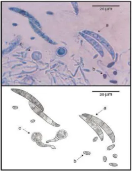 Gambar  3.  Morfologi  makrokonidium,  mikrokonidium,  dan  klamidospora  Fusarium  oxysporum  f.sp