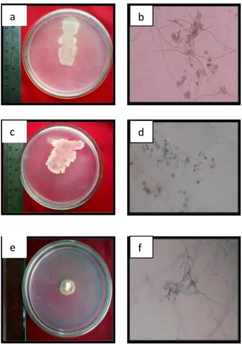Gambar  3.  Koloni  dan  mikroskopis  isolat  Keterangan:    a-b.  RB3S42  Streptomyces  sp