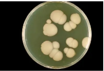 Gambar 2.2. Jamur Candida albicans ((Dwidjoseputro, 2005).