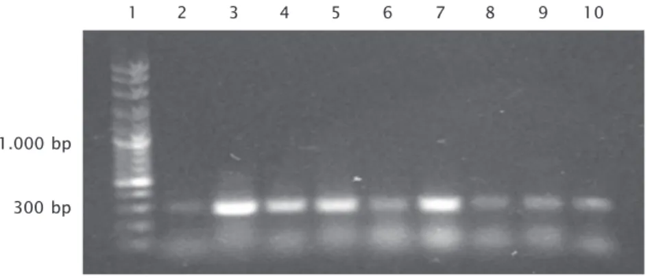 Gambar 2. Hasil analisis PCR terhadap ikan terinfeksi KHV melalui penyuntikan filtrate homogenate KHV