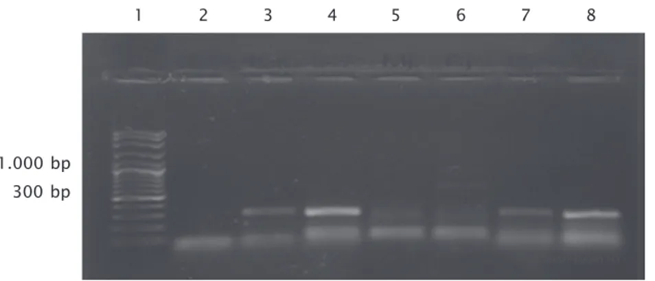 Gambar 4. Hasil analisis PCR pada ikan uji yang menunjukkan gejala klinis ter- ter-infeksi KHV