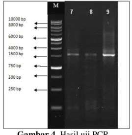 Gambar 4. Hasil uji PCR 