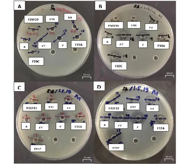 Gambar 5.2 Hasil Uji ZOI kombinasi fraksi polar (F29-F32) Phyllanthus niruri, L. dengan Amoxicillin dan  Chloramphenicol terhadap bakteri S.aureus; A
