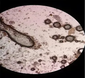 Gambar 4.2 Struktur mikroskopis   simplisia daun pirdot 